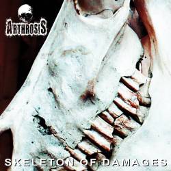 Arthrosis : Skeleton of Damages